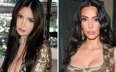 Una influencer brasileña se hizo 40 procedimientos estéticos para parecerse a Kim Kardashian